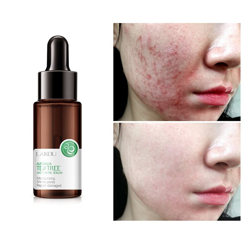 Suero Facial Antiacne Tea Tree – 17 ml